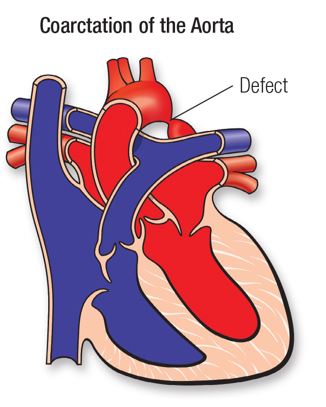 CoA diagram