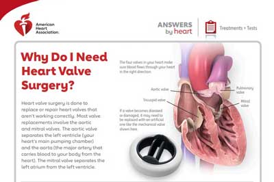 Heart valve surgery Answers by Heart sheet